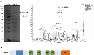 Ubiquitination Destabilizes Protein Sphingosine Kinase 2 to Regulate Glioma Malignancy